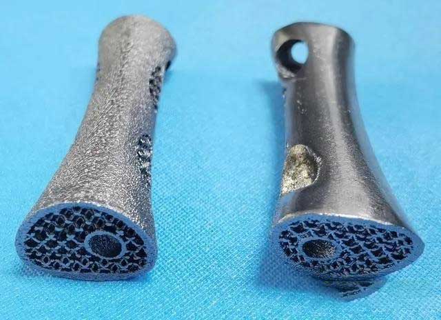 世界首例3D打印钽金属人工椎体临床应用研究在西安完成